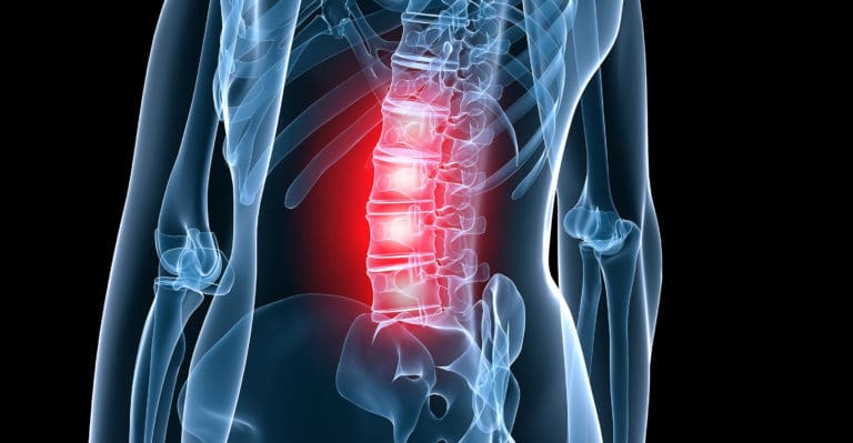 DFW Business Group on Health – War of the Back Pain